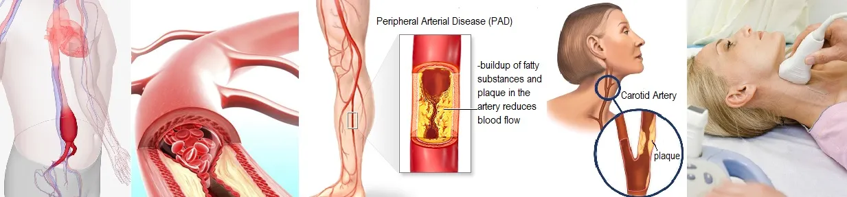 vascular center